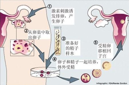 代怀选性别包生男孩